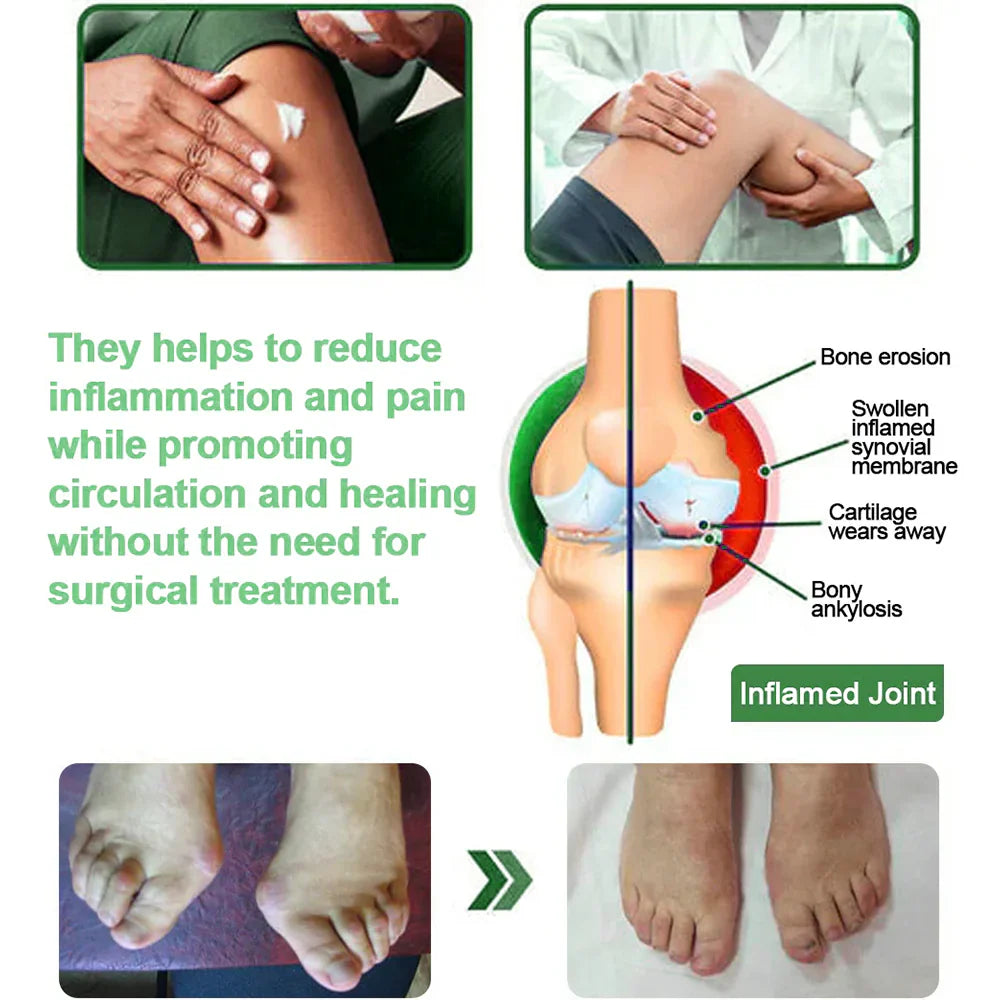 🎁💗Final 3 Hours: 60% OFF 𝐎𝐟𝐟𝐢𝐜𝐢𝐚𝐥 𝐒𝐭𝐨𝐫𝐞: Minceetbien™ Mint Pain Relief Cream