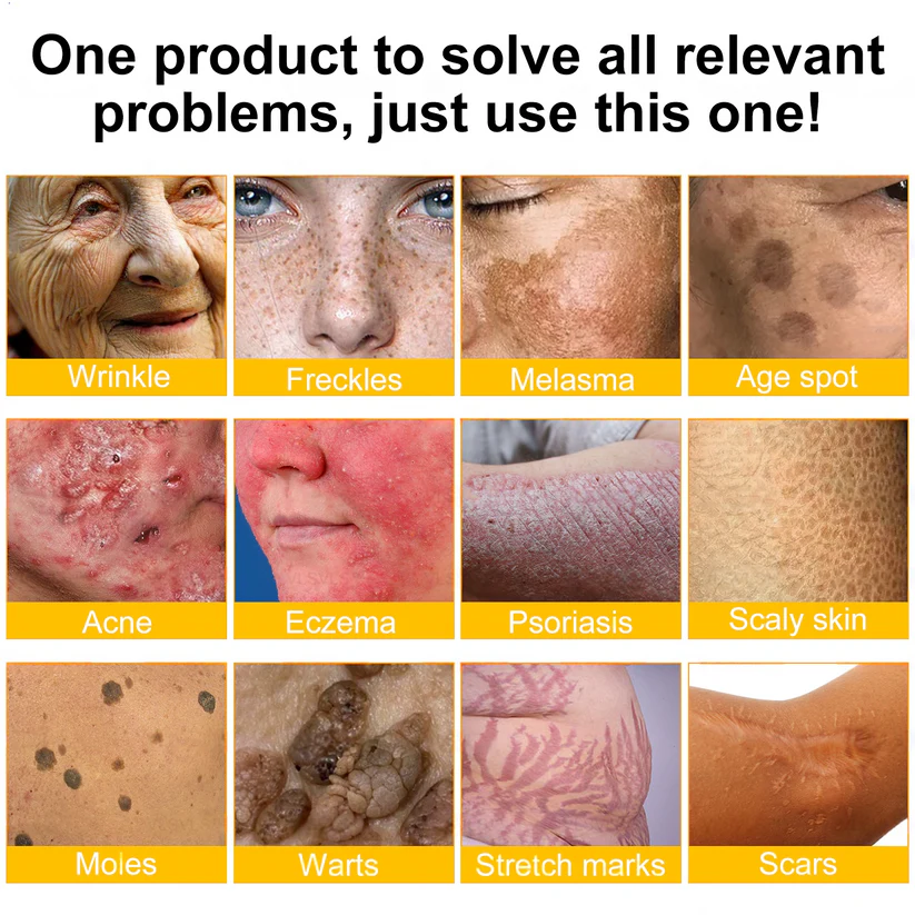 🚀FDA Approved:Minceetbien® Bee venom Pro Comprehensive Cream — 🔥Limited Time 80% OFF🔥