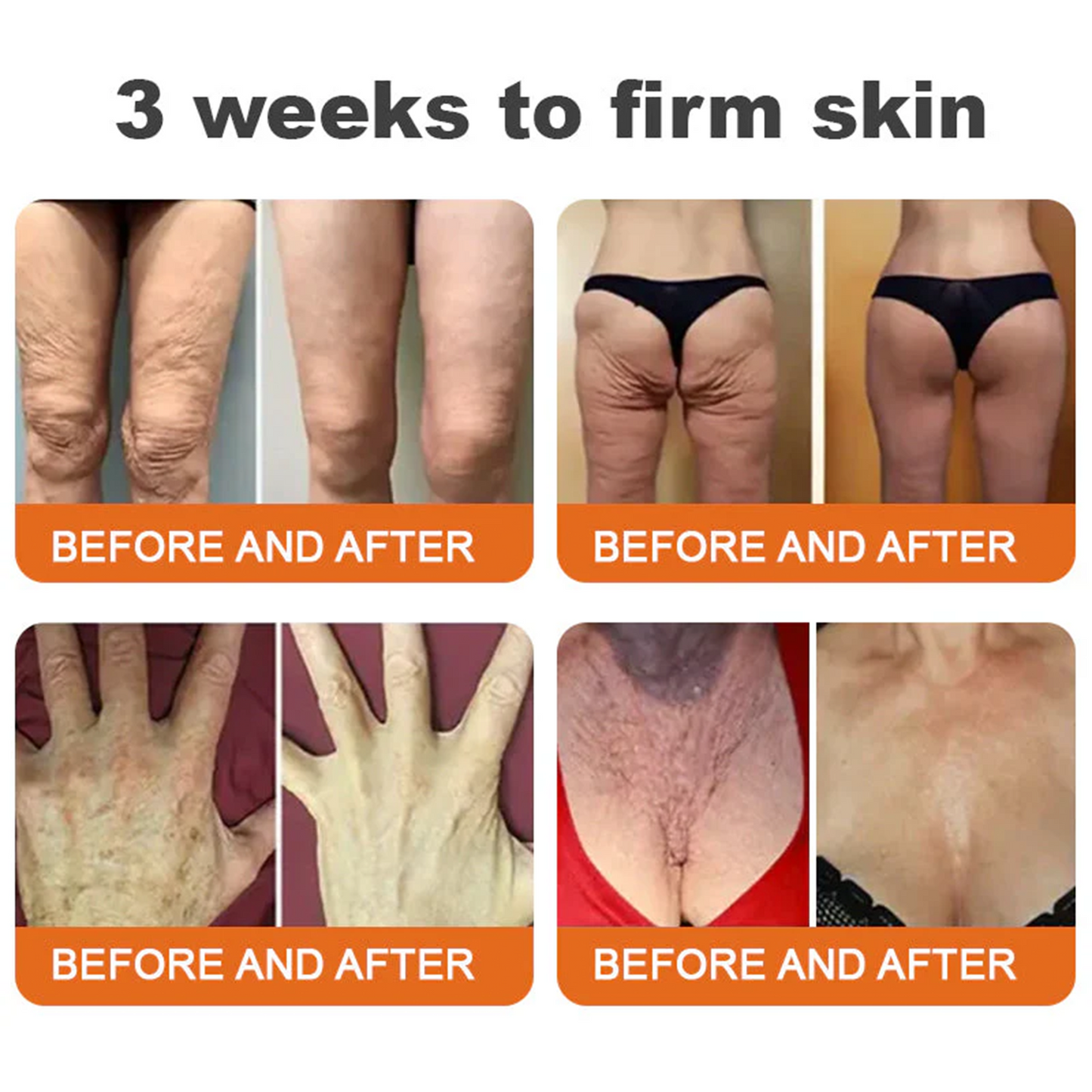 🚀FDA Approved:Minceetbien® Bee venom Pro Comprehensive Cream — 🔥Limited Time 80% OFF🔥