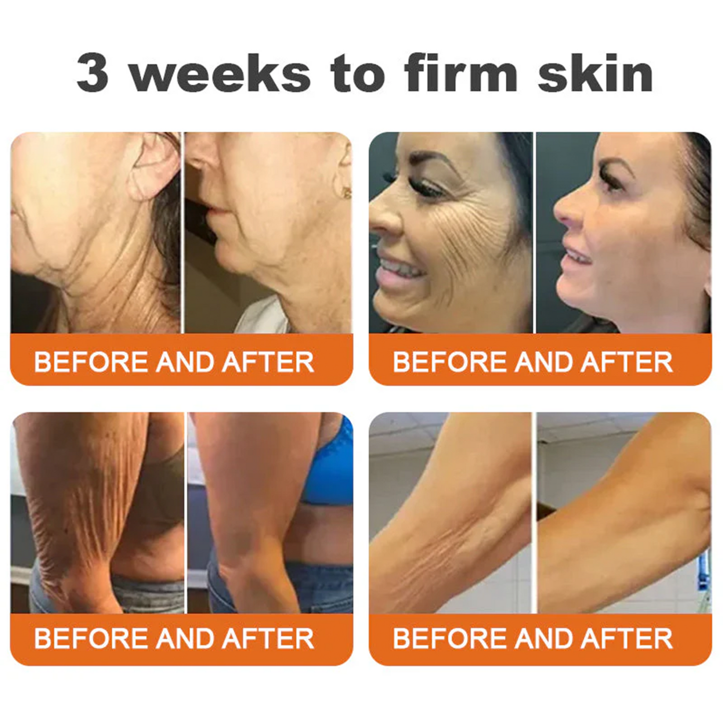 🚀FDA Approved:Minceetbien® Bee venom Pro Comprehensive Cream — 🔥Limited Time 80% OFF🔥