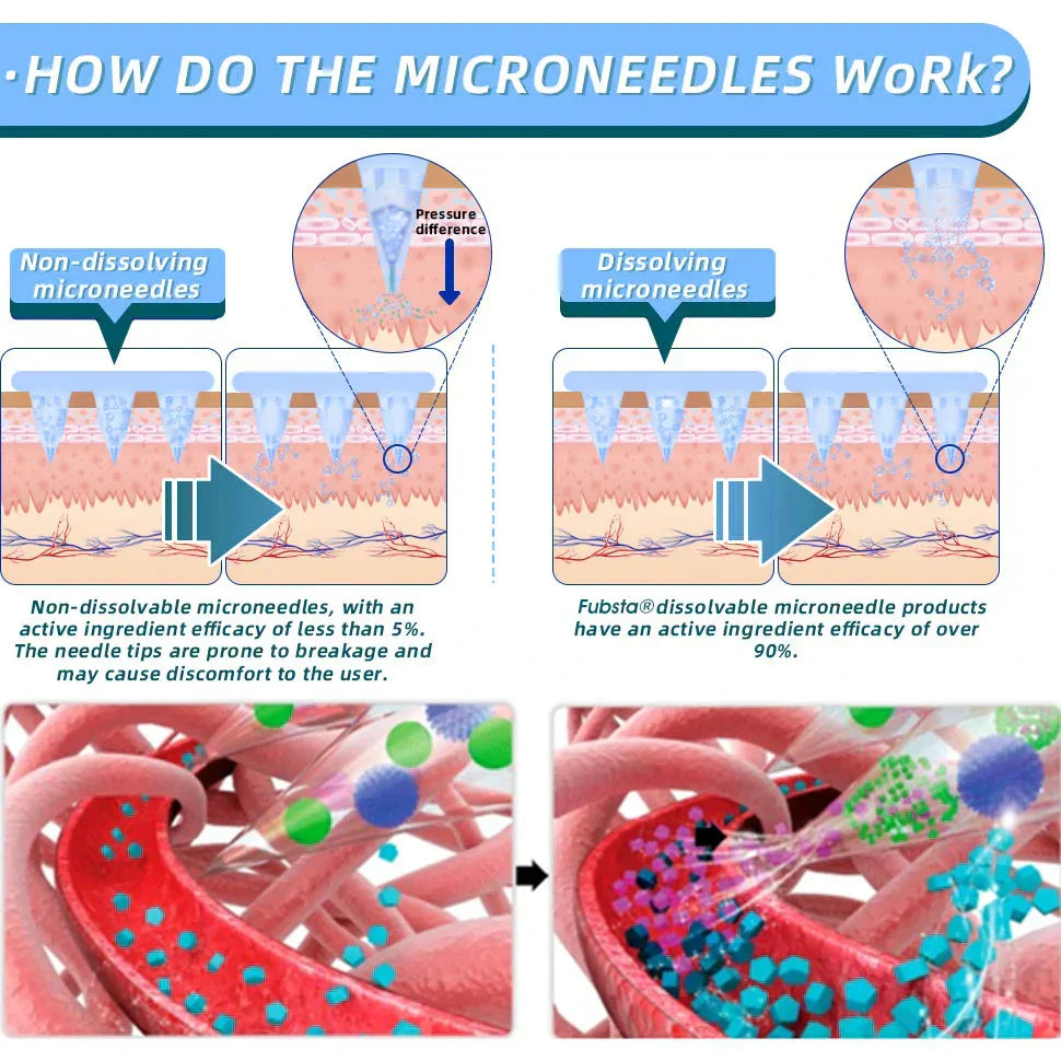 【2025 Medical Grade Newly Upgraded🥇】🇺🇸🇺🇸Lmipki® NIDDK-Tirzepatide Nano Microneedle Patch (Zero Pain, 24/7 Release | Lose 20lbs FAST | 90% Sugar Drop | )