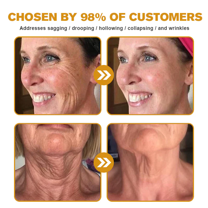 👑👑TGA Approved:Minceetbien® Bee venom Pro Comprehensive Cream — 🔥Limited Time 80% OFF🔥