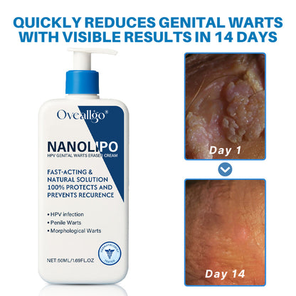 💪Oveallgo® NanoLipo HPV Genital Warts Eraser Cream
