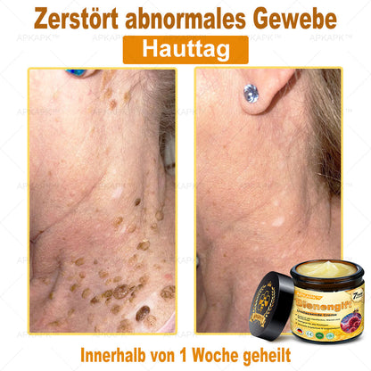 Hergestellt in Deutschland ✨AРKAРК™ Bienengift Umfassende Creme – Anti-Aging, Feuchtigkeitsspendend, Hautreparatur, Hautbildverbesserung, Akne- und Pigmentfleckenbehandlung, Warzen- und Muttermalentfernung, Linderung bei Psoriasis
