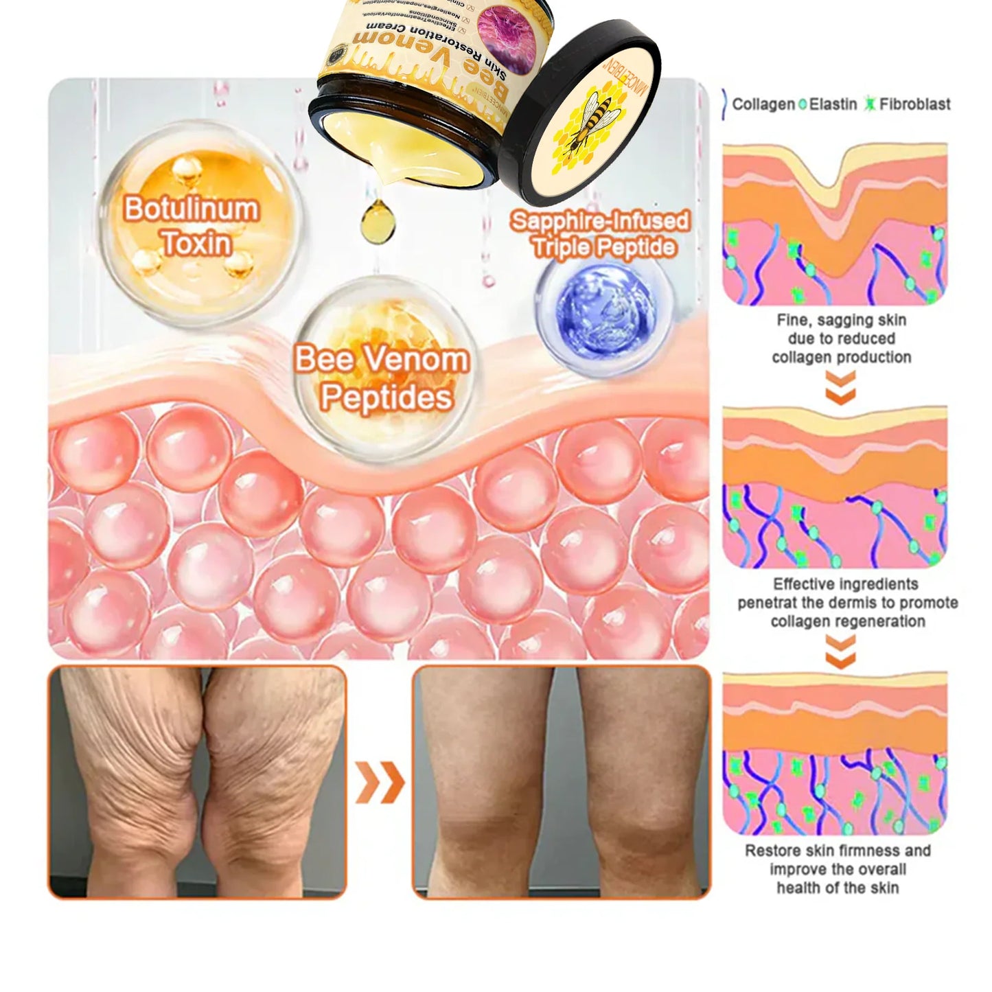 👑👑TGA Approved:Minceetbien® Bee venom Pro Comprehensive Cream — 🔥Limited Time 80% OFF🔥