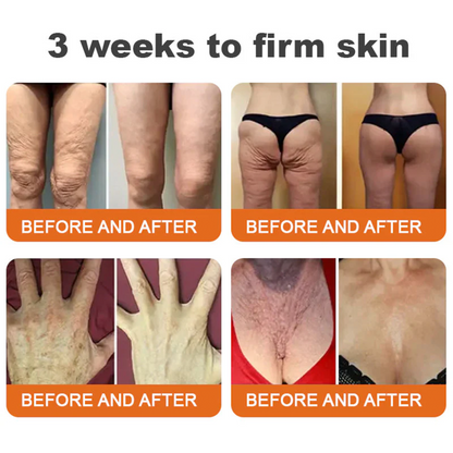 🚀FDA Approved:Minceetbien® Bee venom Pro Comprehensive Cream — 🔥Limited Time 80% OFF🔥