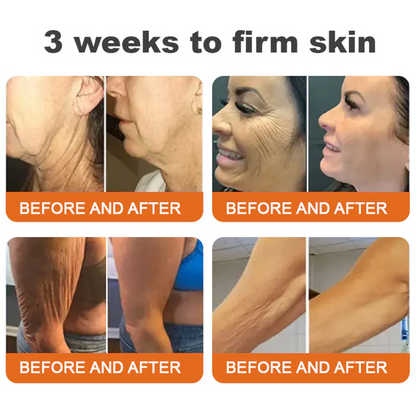 🚀FDA Approved:Minceetbien® Bee venom Pro Comprehensive Cream — 🔥Limited Time 80% OFF🔥